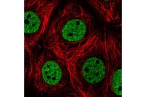 Immunofluorescent staining of MCF7 cells with HNRNPC monoclonal antibody, clone CL2596  (Green) shows distinct nuclear (without nucleoli). (HNRNPC antibody)