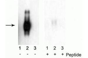 Western blot of immunoprecipitates from HEK 293 cells transfected with 1) Mock, 2) IFNAR1 WT, and 3) IFNAR1 S535A and S539A mutants. (IFNAR1 antibody  (pSer535, pSer539))
