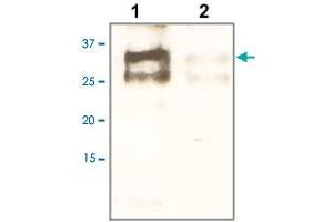 The tissue lysate derived from human liver tissue lysate was immunoprobed by EBAG9 polyclonal antibody  at 1 : 500.
