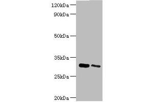 Western blot All lanes: Chloride intracellular channel protein 4 antibody at 5 μg/mL Lane 1: Mouse kidney tissue Lane 2: Mouse ovarian tissue Secondary Goat polyclonal to rabbit IgG at 1/10000 dilution Predicted band size: 29 kDa Observed band size: 29 kDa (CLIC4 antibody  (AA 1-253))
