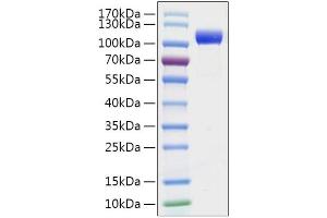 Recombinant 2019-nCoV Spike S1 Protein with His tag was determined by SDS-PAGE with Coomassie Blue, showing a band at 110-130 kDa.