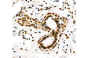 Immunohistochemistry (Paraffin-embedded Sections) (IHC (p)) image for anti-Transketolase (TKT) antibody (ABIN7075978)
