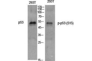 Western Blotting (WB) image for anti-Tumor Protein P53 (TP53) (pSer15) antibody (ABIN3182104)