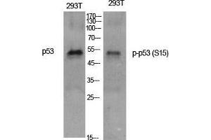 Western Blot (WB) analysis of specific cells using Phospho-p53 (S15) Polyclonal Antibody. (p53 antibody  (pSer15))