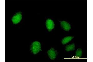 Immunofluorescence of purified MaxPab antibody to C8orf70 on HeLa cell. (FAM164A antibody  (AA 1-325))