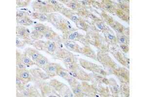 Immunohistochemistry of paraffin-embedded Human liver using UCHL3 Polyclonal Antibody at dilution of 1:100 (40x lens). (UCHL3 antibody)