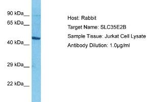 Host: Rabbit Target Name: SLC35E2B Sample Type: Jurkat Whole Cell lysates Antibody Dilution: 1.