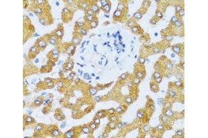 Immunohistochemistry of paraffin-embedded Human liver using CCL25 Polyclonal Antibody at dilution of 1:100 (40x lens).