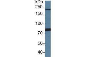 Detection of PI4Ka in Rat Cerebrum lysate using Polyclonal Antibody to Phosphatidylinositol-4-Kinase Catalytic Alpha (PI4Ka) (PI4KA antibody  (AA 1-300))