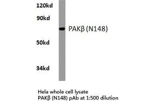 Western blot (WB) analysis of PAKβ antibody in extracts from hela cells. (PAK3 antibody)