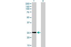 Western Blot analysis of PSPH expression in transfected 293T cell line by PSPH monoclonal antibody (M02), clone 2G9.