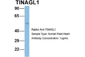 Host: Rabbit Target Name: TINAGL1 Sample Type: Human Fetal Heart Antibody Dilution: 1. (TINAGL1 antibody  (Middle Region))