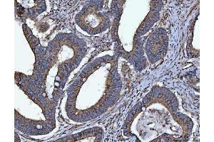 IHC analysis of HMGCR using anti-HMGCR antibody (ABIN7600989).