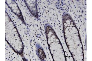 Immunoperoxidase of monoclonal antibody to SETD7 on formalin-fixed paraffin-embedded human colon. (SETD7 antibody  (AA 257-366))