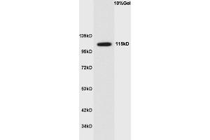 Human colon cancer lysate probed with Anti Phospho-Ack1(Tyr284) Polyclonal Antibody, Unconjugated  at 1:3000 for 90 min at 37˚C. (TNK2 antibody  (pTyr284))