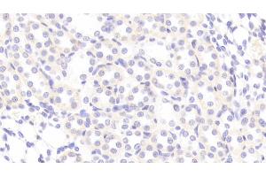 TNC antibody  (AA 175-342)
