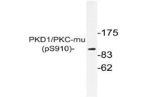 Western blot (WB) analysis of p-PKD1/PKC-mu antibody in extracts from NIH/3T3 PDGF cells . (PKC mu antibody  (pSer910))