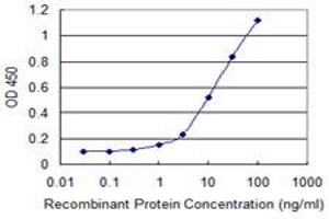Detection limit for recombinant GST tagged ELA3B is 0. (Elastase 3B antibody  (AA 19-270))