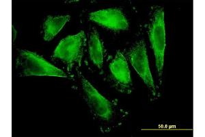 Immunofluorescence of monoclonal antibody to RFNG on HepG2 cell. (RFNG antibody  (AA 82-190))