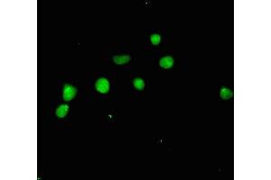 Immunofluorescent analysis of HepG2 cells using ABIN7144946 at dilution of 1:100 and Alexa Fluor 488-congugated AffiniPure Goat Anti-Rabbit IgG(H+L) (ACLY antibody  (AA 4-265))