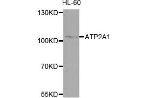 Western blot analysis of extracts of HL-60 cells, using ATP2A1 antibody. (ATP2A1/SERCA1 antibody)