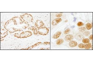 Immunohistochemistry (IHC) image for anti-Splicing Factor 3b, Subunit 1, 155kDa (SF3B1) (AA 200-250) antibody (ABIN7453785)