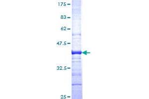 Image no. 1 for Glypican 1 (GPC1) (AA 24-131) protein (GST tag) (ABIN1355524) (GPC1 Protein (AA 24-131) (GST tag))