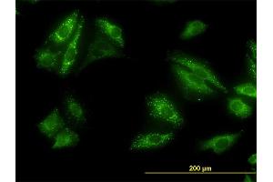 Immunofluorescence of monoclonal antibody to SQSTM1 on HeLa cell.