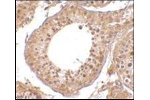 Immunohistochemistry of RGPD5 in human testis tissue cells with this product at 10 μg/ml. (RGPD5 / RGPD6 (N-Term) antibody)