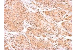 IHC-P Image ZNF134 antibody detects ZNF134 protein at cytosol on Cal27 xenograft by immunohistochemical analysis. (ZNF134 antibody)