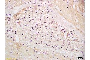 Formalin-fixed and paraffin embedded human stomach labeled with Anti EEA1 Polyclonal Antibody, Unconjugated (ABIN1385839) at 1:200 followed by conjugation to the secondary antibody and DAB staining. (EEA1 antibody  (AA 1251-1350))