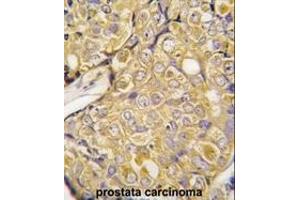 Image no. 2 for anti-Transient Receptor Potential Cation Channel, Subfamily M, Member 8 (TRPM8) (Middle Region) antibody (ABIN360716) (TRPM8 antibody  (Middle Region))