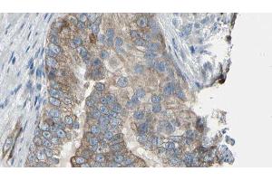 ABIN6276452 at 1/100 staining Human prostate tissue by IHC-P. (TPMT antibody  (N-Term))