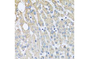 Immunohistochemistry of paraffin-embedded human liver injury using UQCRC2 antibody. (UQCRC2 antibody  (AA 224-453))