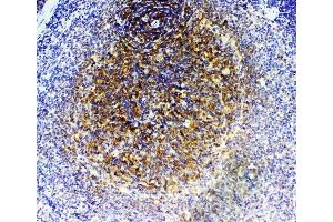 IHC analysis of GRK2 using anti-GRK2 antibody (ABIN5693069). (GRK2 antibody)