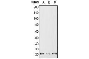 Western blot analysis of RAC2 expression in Jurkat (A), SP2/0 (B), H9C2 (C) whole cell lysates. (RAC2 antibody  (C-Term))