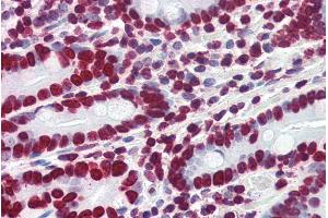ABIN185443 (4µg/ml) staining of paraffin embedded Human Small Intestine. (HMGA1 antibody  (Internal Region))