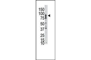 Western blot analysis of anti-EphB6 N-term Pab (ABIN391927 and ABIN2841737) in A549 cell lysate. (EPH Receptor B6 antibody  (N-Term))