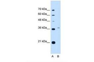 Image no. 2 for anti-Peroxisomal Biogenesis Factor 3 (PEX3) (AA 31-80) antibody (ABIN321040) (PEX3 antibody  (AA 31-80))