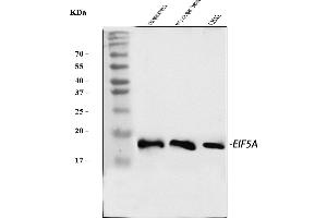 Western blot analysis of EIF5A using anti-EIF5A antibody (ABIN7602568). (EIF5A antibody  (AA 86-154))