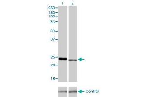 Western blot analysis of RAB7L1 over-expressed 293 cell line, cotransfected with RAB7L1 Validated Chimera RNAi (Lane 2) or non-transfected control (Lane 1).