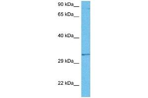 Host:  Rat  Target Name:  GTF2B  Sample Tissue:  Rat Brain  Antibody Dilution:  1ug/ml (GTF2B antibody  (N-Term))