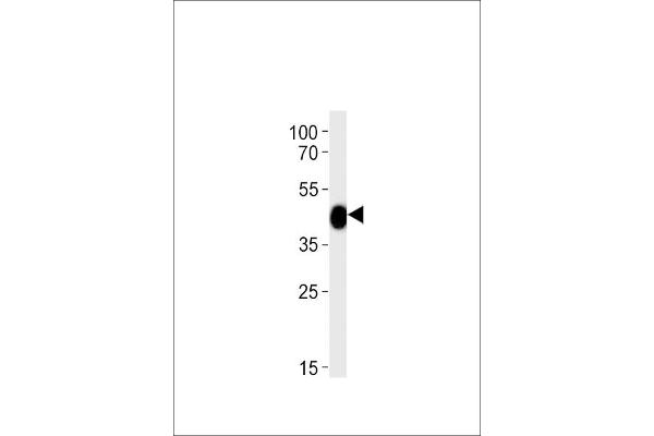 CHST11 antibody  (AA 131-155)