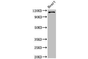Western Blot Positive WB detected in: Mouse heart tissue All lanes: ITGA5 antibody at 4 μg/mL Secondary Goat polyclonal to rabbit IgG at 1/50000 dilution Predicted band size: 115 kDa Observed band size: 115 kDa (ITGA5 antibody  (AA 220-472))