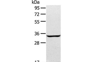 Western Blot analysis of A172 cell using STX2 Polyclonal Antibody at dilution of 1:400 (STX2 antibody)