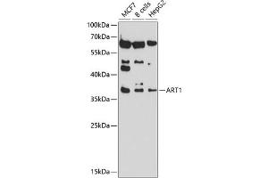 Western blot analysis of extracts of various cell lines, using  antibody (ABIN6129884, ABIN6137152, ABIN6137153 and ABIN6214229) at 1:1000 dilution. (ART1 antibody  (AA 23-295))