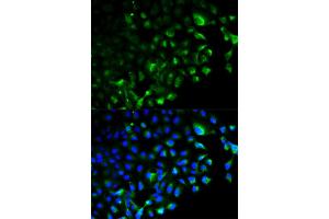 Immunofluorescence analysis of HeLa cells using TRAF2 antibody. (TRAF2 antibody)
