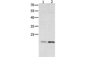 Western Blot analysis of 231 cell and Human fetal liver tissue using HMGB4 Polyclonal Antibody at dilution of 1:500 (HMGB4 antibody)