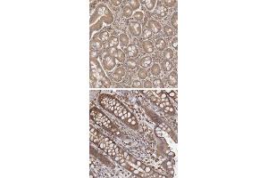 Immunohistochemical staining of human rectum with ARHGEF10L polyclonal antibody  shows strong cytoplasmic positivity. (ARHGEF10L antibody)