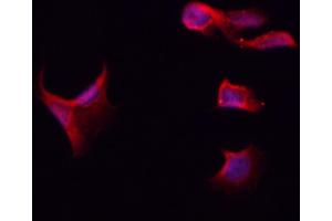 ABIN6261115 and ABIN6266521 staining Hela by IF/ICC.
